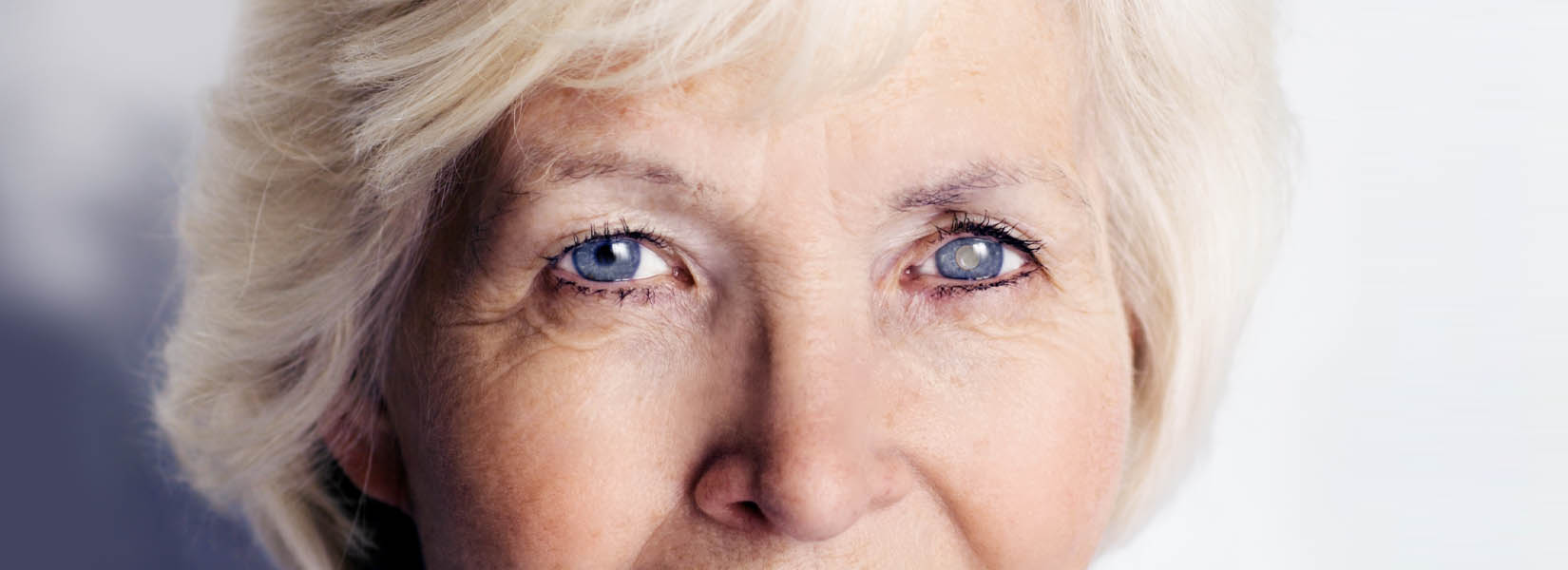 Cataract Surgery in Findlay